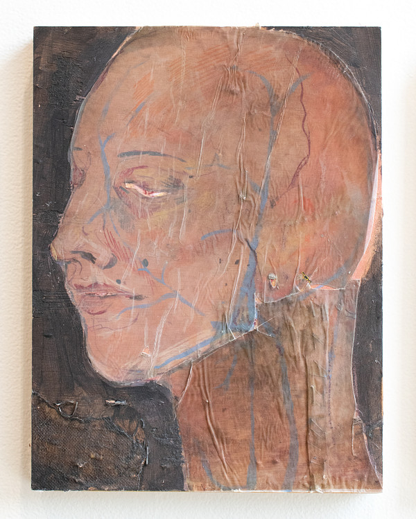 Head 1
